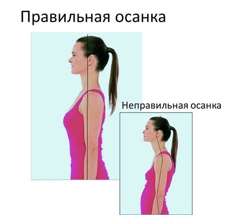 Зачем нужна правильная осанка