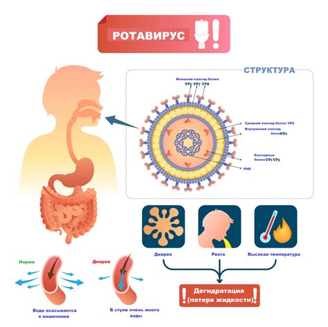 Ротовирус: основные симптомы и характеристики
