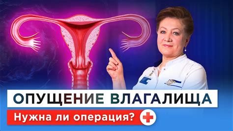 Советы по выбору белья при опущении матки