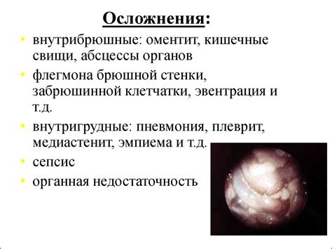 Абдоминальный доступ и его особенности