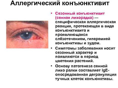 Аллергическая реакция или конъюнктивит