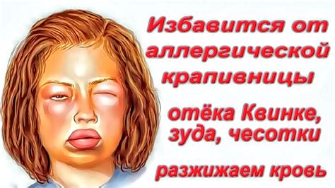 Аллергические реакции как возможная причина зуда в области подмышки