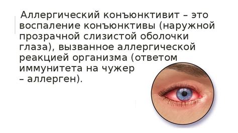 Аллергический коньюктивит: основные принципы терапии и предотвращения
