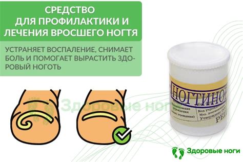 Алоэ вера: естественное средство для лечения вросшего ногтя