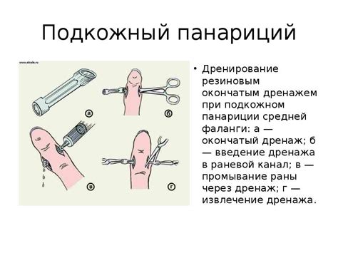 Альтернативные методы лечения гнойных ниток в глазах