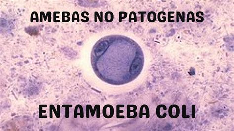 Альтернативы для лечения инфекции Entamoeba coli у детей