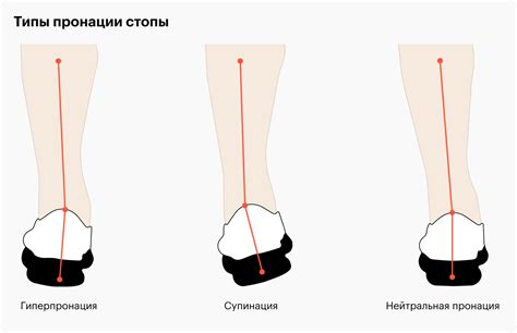 Анализ своей стопы: тип арки стопы