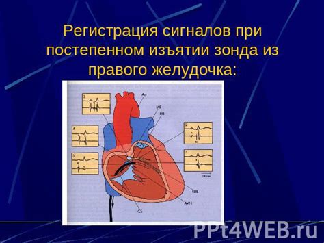 Анализ электрической активности сердца