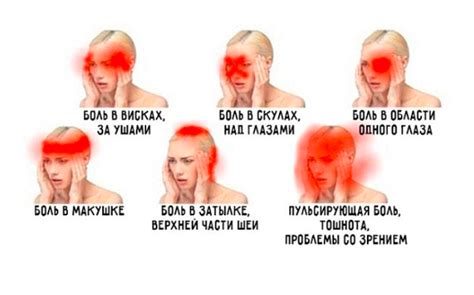 Боли в висках: причины и значения