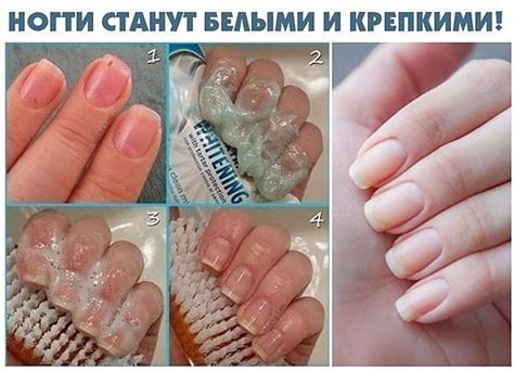 Важность правильного ухода за ногтями для предотвращения искривления
