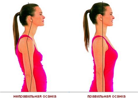 Важность правильной осанки для профилактики ограниченности движений в области шеи