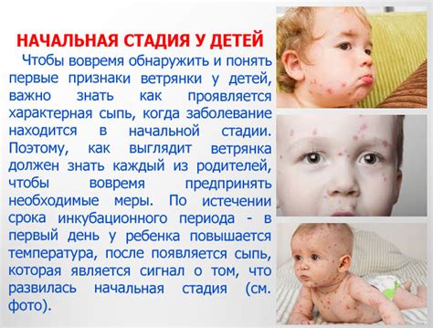 Ветрянка: проявление и первые признаки