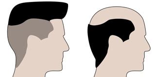 Взаимосвязь между сновидением и состоянием волос: как одно отражает другое