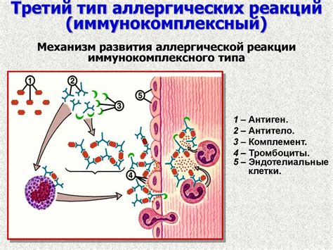 Влияние аллергических реакций на возникновение зуда в правой стопе: важная информация