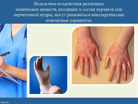 Влияние глюкоманнана на кожу
