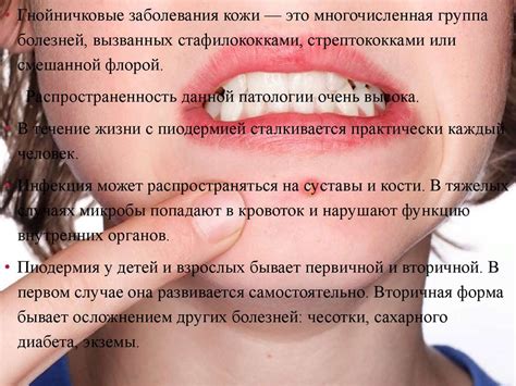 Влияние диеты на появление гнойников