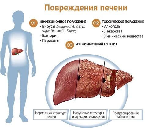 Влияние инфекционных заболеваний на возникновение увеличения печени у детей