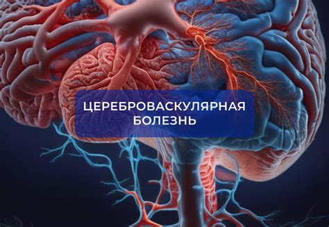 Влияние курения на сужение сосудов головного мозга