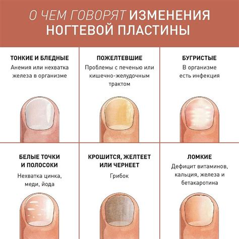 Влияние надлежащего покрытия на состояние ногтей