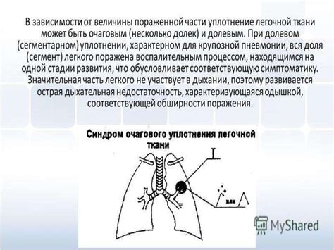 Влияние перевернутого положения тела на аэрацию легочной ткани