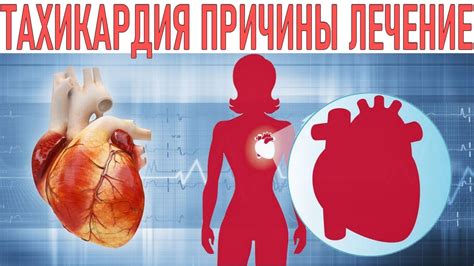 Воздействие быстрого сердцебиения на организм: важно знать последствия