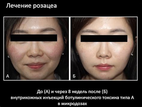 Возможности сквалана в решении проблем кожи