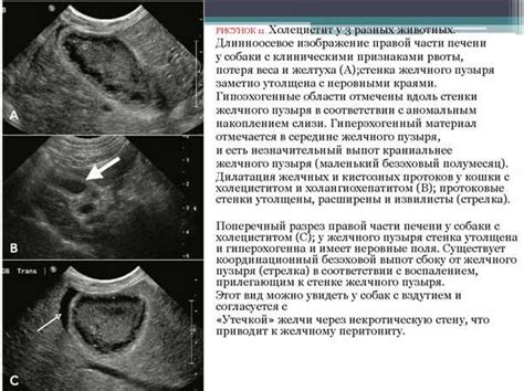 Возможные методы лечения гомогенного содержимого желчного пузыря