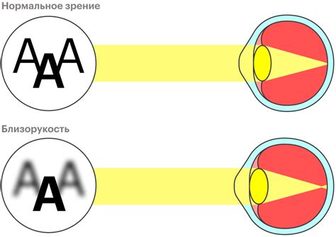 Возможные причины мигания глаз