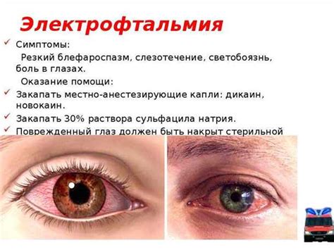 Возможные причины психосоматической боли в глазах