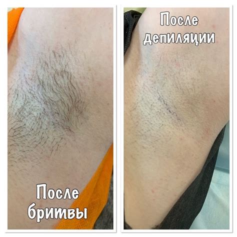 Волосы обрываются после процедуры бритья: причины и рекомендации