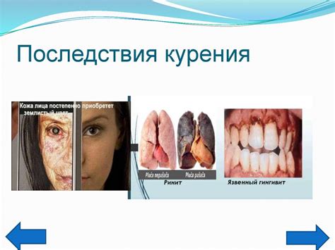 Вредные последствия гидроцефалии для организма