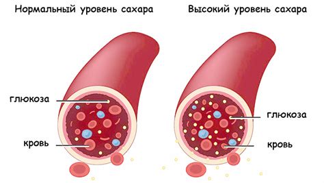 Высокий уровень сахара в крови 13.5: причины и факторы риска