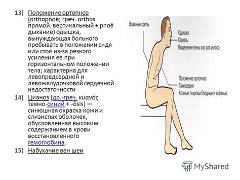 Выявление основного источника головного кружения при горизонтальном положении тела