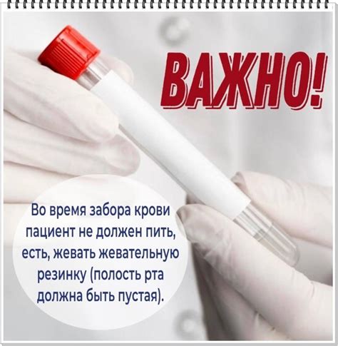Выявление факторов, привлекающих внимание и критериев, делающих вас объектом спринцевания