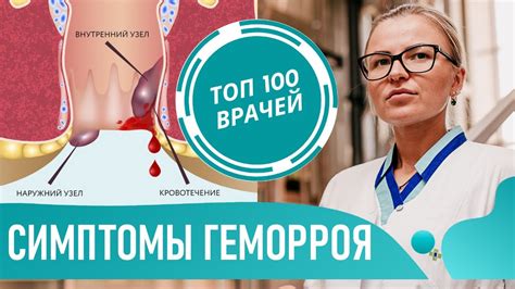 Геморрой как широко распространенное заболевание
