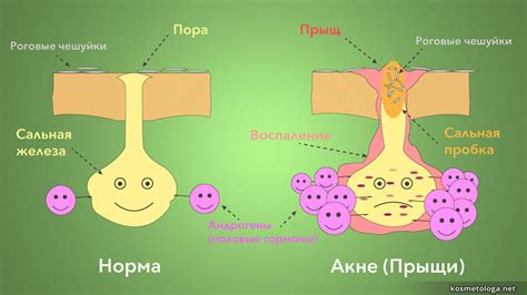 Главные причины появления глубоких бороздок