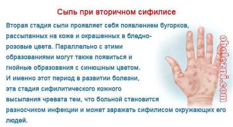 Главные факторы появления тревожных высыпаний на коже пальцев