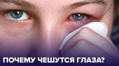 Глаза чешутся одновременно: возможные причины и методы облегчения