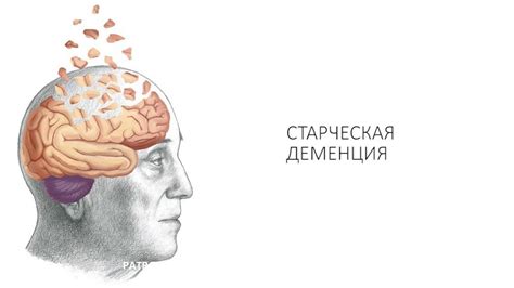 Глубокая деменция: основные симптомы