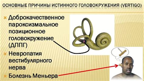 Головокружение: основные признаки