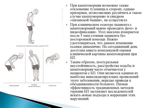 Головокружение при изменении позы