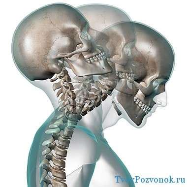 Головокружение при нестабильности шейных позвонков