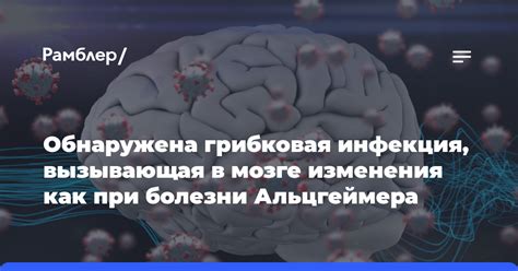 Грибковая инфекция