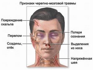 Гроза как причина тревоги: основания и последствия