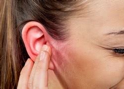 Дерматит подмышки: причины и способы смягчения неприятного ощущения
