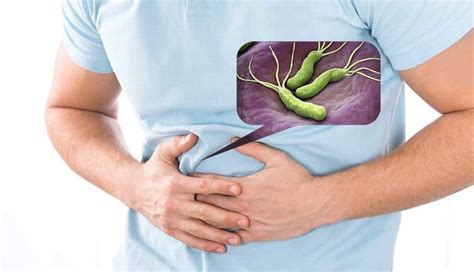 Диагностика инфекции по наличию антигена Helicobacter pylori