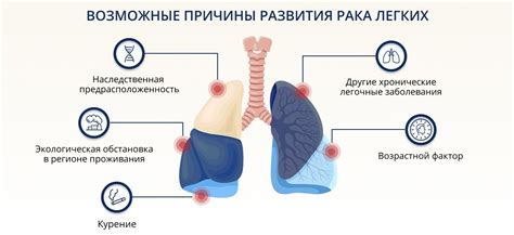 Диагностика и лечение гомогенного затемнения легких