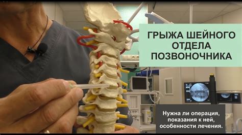 Диагностика и лечение осевого изгиба шейного отделения позвоночника
