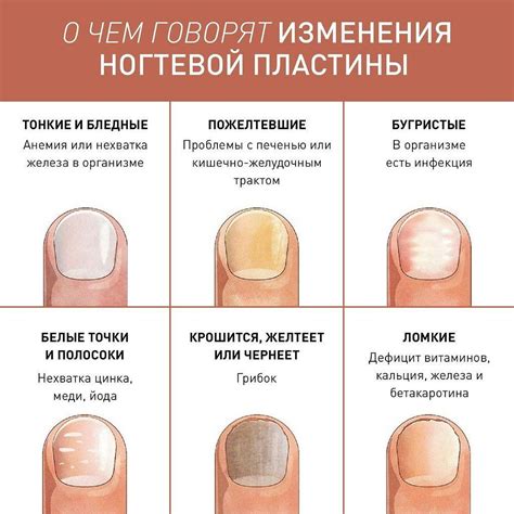 Диагностика и симптомы утолщений на пальцах и руке
