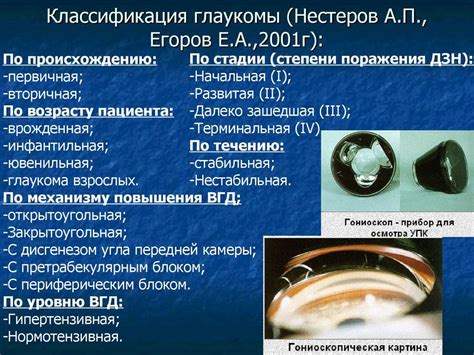 Диагностика узкоугольной глаукомы